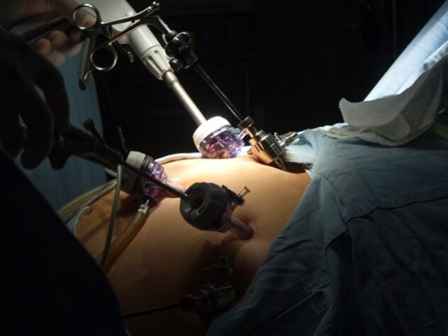 Bariatric Surgery